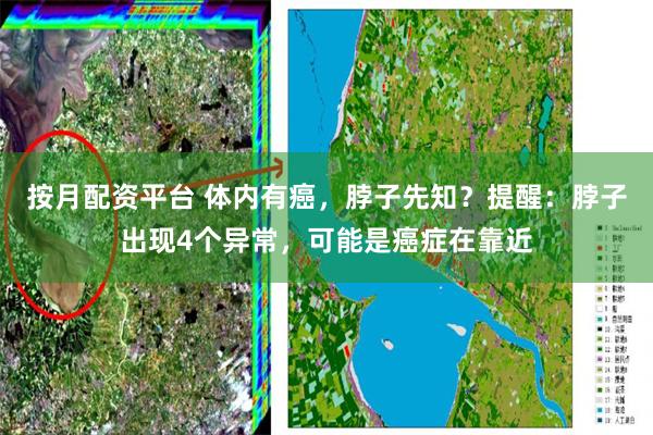 按月配资平台 体内有癌，脖子先知？提醒：脖子出现4个异常，可能是癌症在靠近