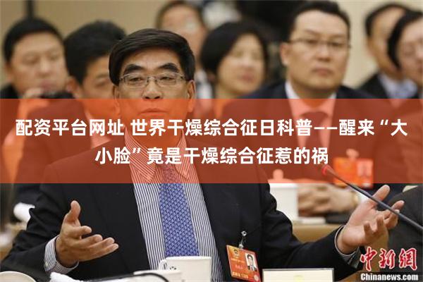 配资平台网址 世界干燥综合征日科普——醒来“大小脸”竟是干燥综合征惹的祸
